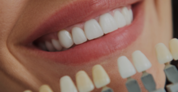 bleach bright teeth whitening services - central Illinois